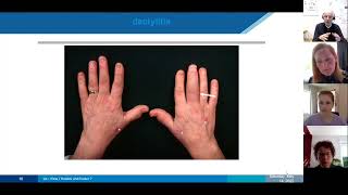 Webinar: axiale en perifere SpA