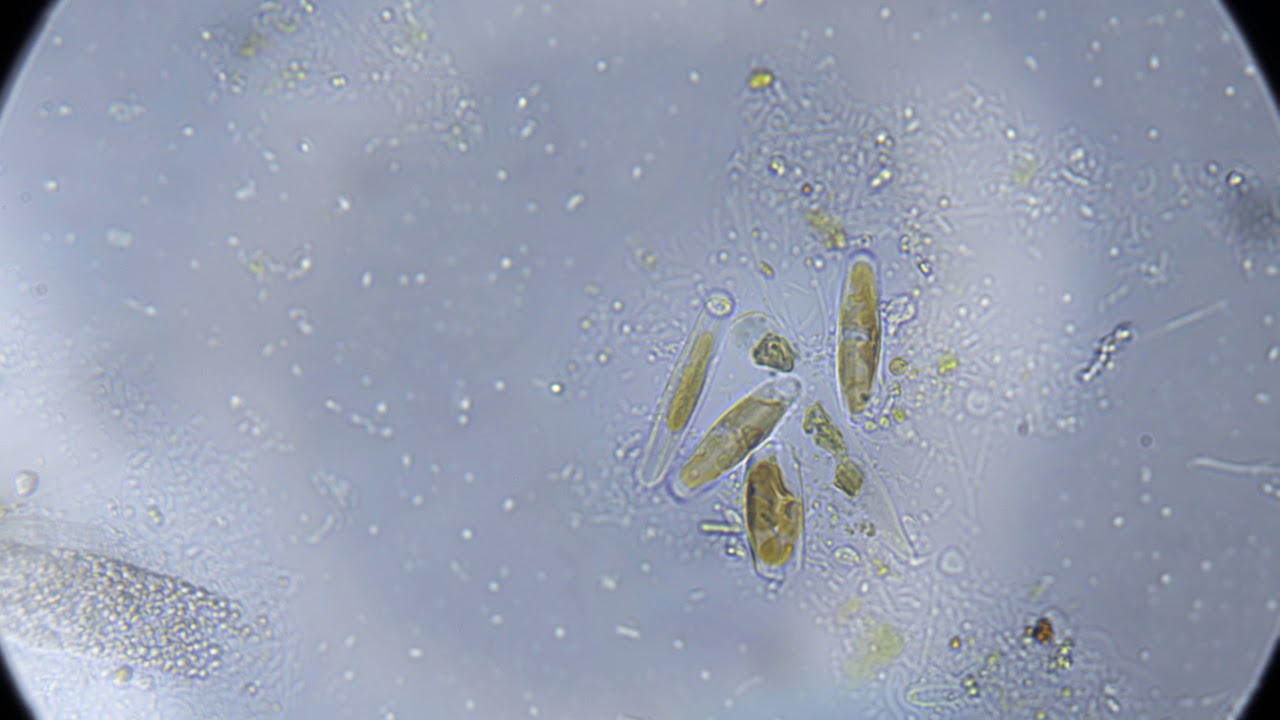 Film Algae Aquarium Glass 08112018 13 YouTube