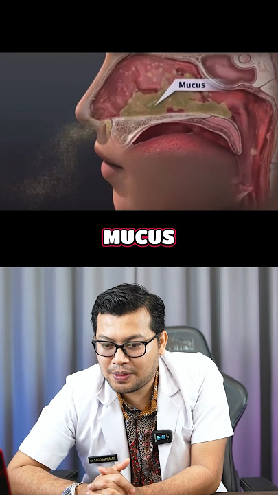 Hidung sering berlendir ternyata ini yang terjadi #reaction #lucu #lendir #dokter #pilek #edukasi