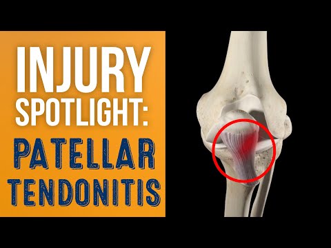 What is Patellar Tendonitis (Jumper&rsquo;s Knee)?