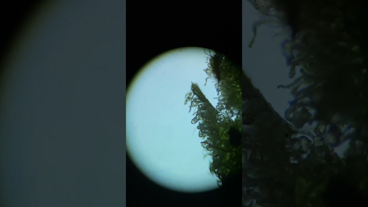 Trichomes under microscope 