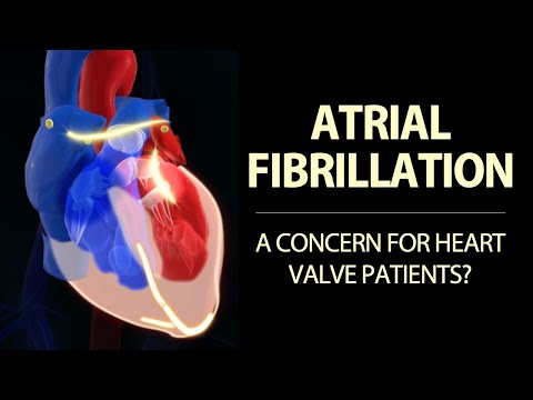 Atrial Fibrillation & Heart Valve Disease: Surgeon Insights with Dr. Marc Gerdisch