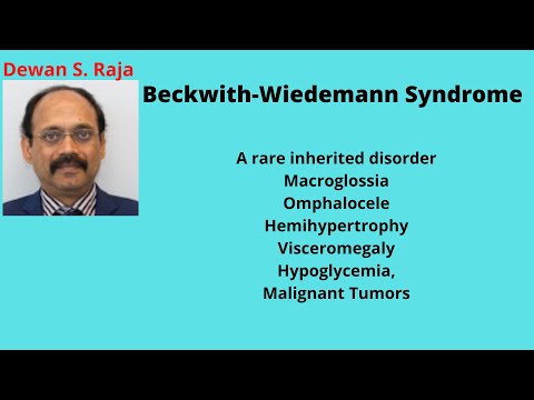 Beckwith-Wiedemann Syndrome