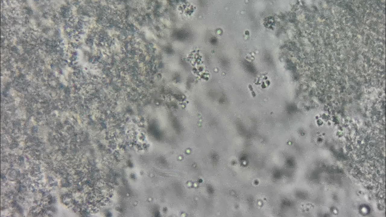 Bacteria in yogurt under microscope YouTube