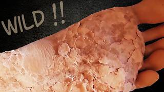 Wide sections lift and Callus peels in broken lines at once