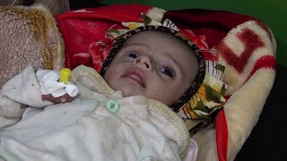 أطفال اليمن.. ضحايا الحرب المنسية