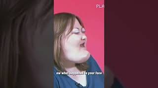 Ew what happened to your face