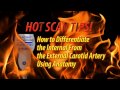 Hot Tip-How to Differentiate the Internal from the  External Carotid Artery
