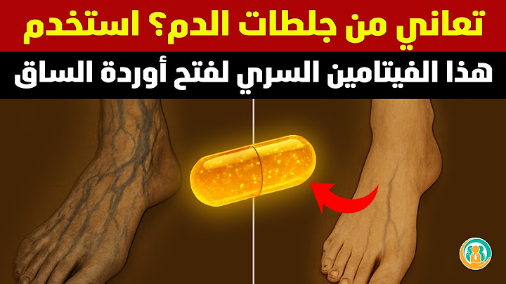 هذا الفيتامين يذوب جلطات الدم في ساقيك – يجب أن يعرفه كبار السن!