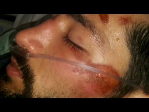 MMA fighter remains hospitalized after scuffle with police officers