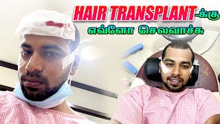 PART-2 Hair Transplant-க்கு எவ்ளோ செலவாச்சு😱 | Step By Step Procedure | JUUJEE VLOGS