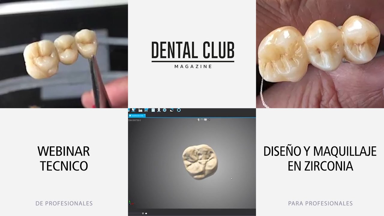 Diseño y maquillaje en zirconia - Webinar Online