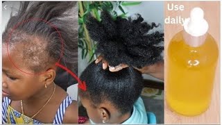 The Most Potent Hair Growth Oil😱Do Not Wash It Out Only 2 Ingredients To Grow Hair Like Crazy