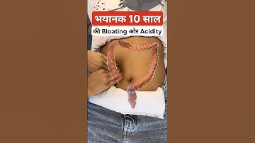 Try this technique for bloating and acidity #trend #ytshort  #feed #feedshort