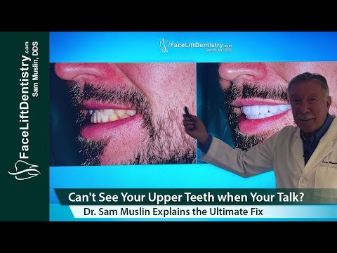 Can't See Your Upper Teeth When Your Talk The 1 Solution!