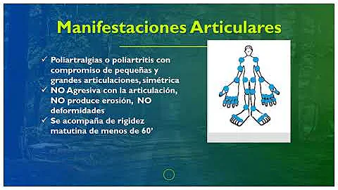 ¿En qué consiste la prueba ocular para detectar la enfermedad de Sjogren?