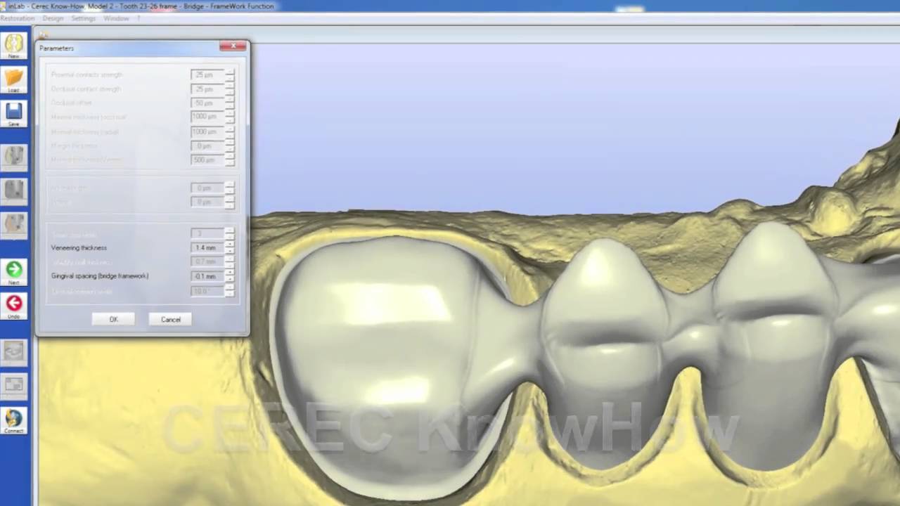 CEREC® parameter - parameter - tips&tricks