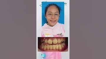 NỤ CƯỜI NÂNG TẦM VẺ ĐẸP TIỀM ẨN