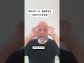 Bell S Palsy Recovery With Face Massage