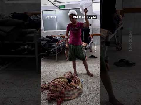 طفلة جريحة ت عين شقيقها الرضيع