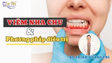 Viêm nha chu - Phương pháp điều trị hết nha chu #nhachu #viemnhachu