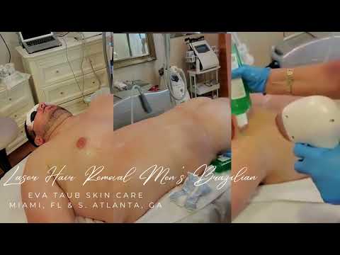 Man's Brazilian Laser Hair Removal Demo