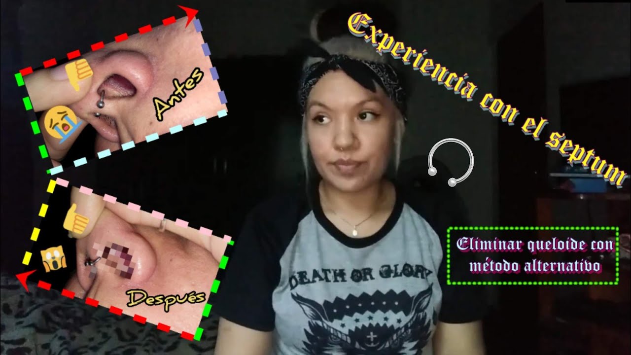 SEPTUM EXPERIENCIA CÓMO CURÉ EL "QUELOIDE" EN EL PIERCING MÉTODO