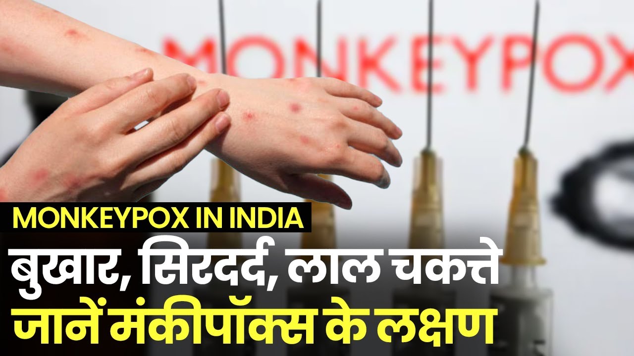 Monkeypox Symptoms: जानें क्या हैं Monkeypox Virus के लक्षण, Delhi सरकार ने जारी की गाइडलाइन