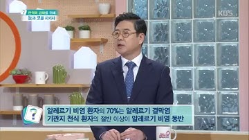 알레르기 비염 환자 70%는 알레르기 결막염 [무엇이든 물어보세요] 20200218