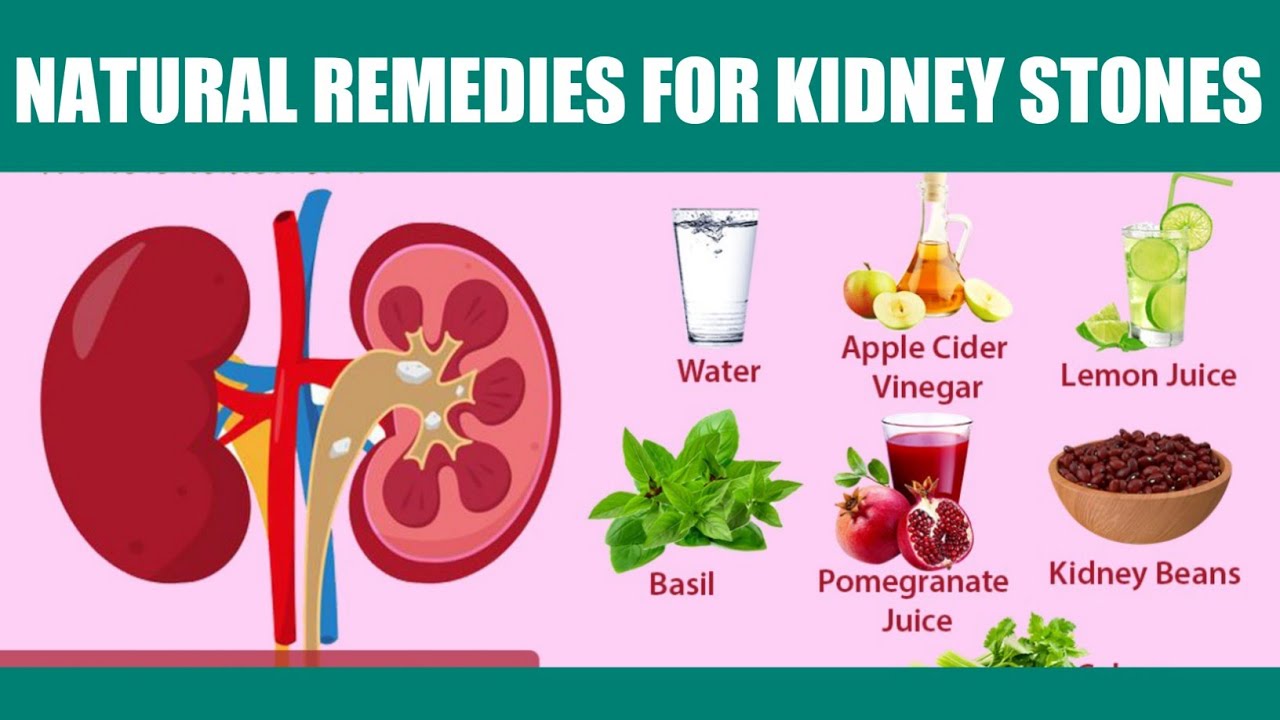 5 Natural Remedies to Fight Kidney Stones at Home