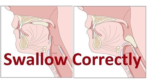 Tips and Exercises on Improving Incorrect Swallowing by Prof John Mew