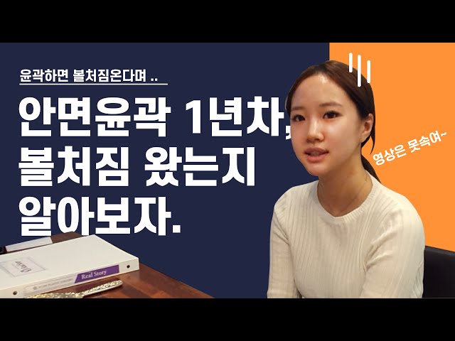 안면윤곽 '1년차', 볼처짐왔는지 체크!!! (영상은 못속여ㅠㅠ)