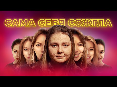 Видео: БОЛЬНО СМЕШНО: ОПАСНЫЙ ОЖОГ В 4 ГОДА/ КАК МНЕ ПЕРЕСАДИЛИ КОЖУ И Я СТАЛА МОДЕЛЬЮ/ САМЫЙ ЖАРКИЙ ВЫПУСК