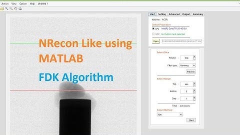 NRecon Like 3D CBCT Reconstruction - Created Using Matlab - FDK Algorithm
