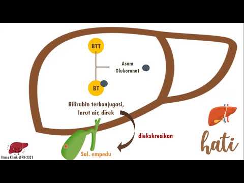 GANGGUAN FUNGSI HATI, METABOLISME BILIRUBIN