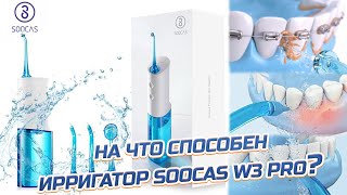 ✅Как пользоваться Ирригатором и зачем он нужен⁉️ Soocas W3 PRO обзор