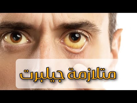 متلازمة جيلبرت