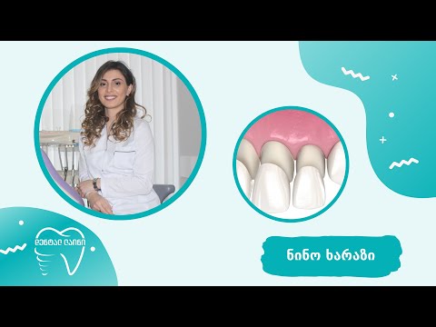 ვიდეო: როგორ შევინარჩუნოთ კბილები ორსულობის დროს