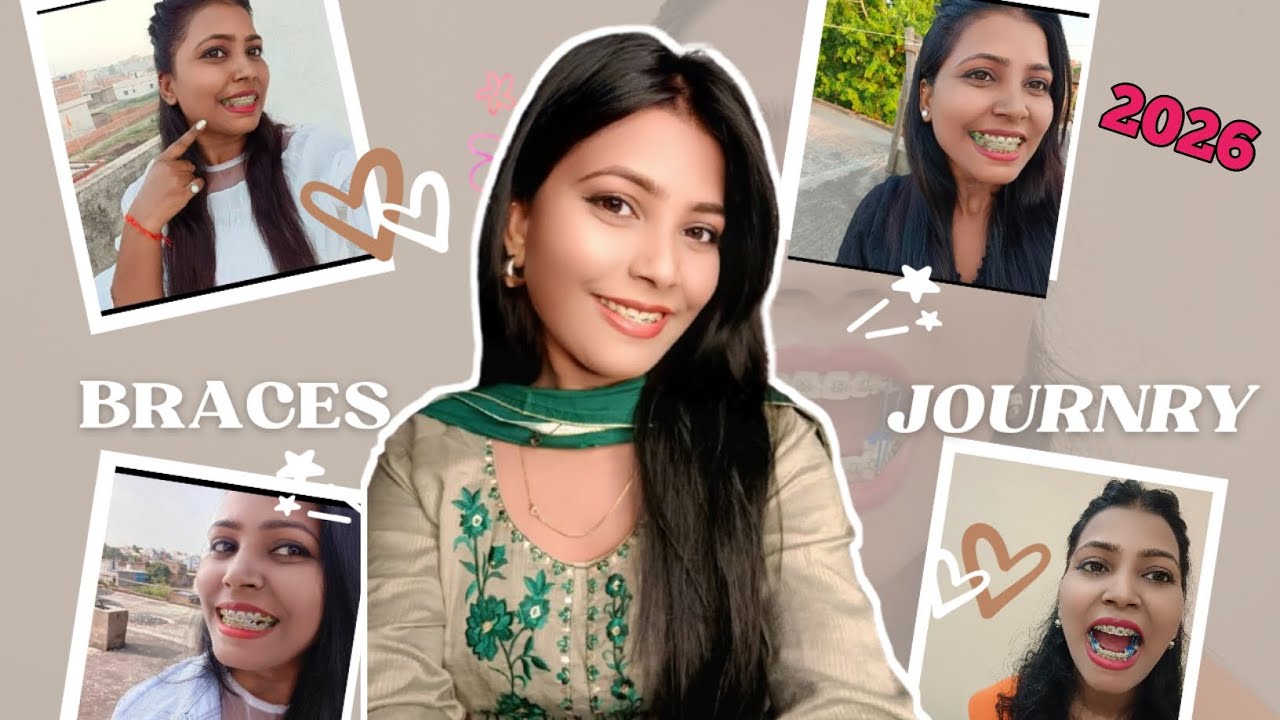 😍 BRACES JOURNEY Changes Transformation 🔥 ll Braces Transformation Video 2026
