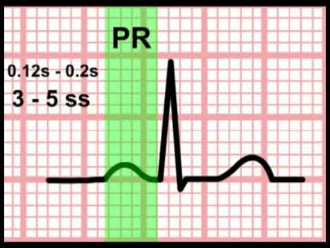 5 ECG Time And The ECG Section 1 Part 5