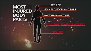 Fireworks first aid