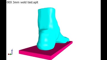 FE foot model with a single segment of metatarsal 12 10 2020