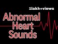 Abnormal Heart Sounds || Mis.Medicine