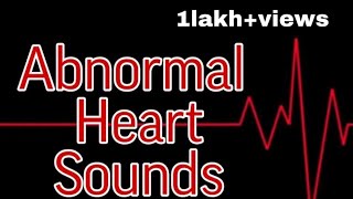 Abnormal Heart Sounds || Mis.Medicine