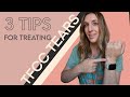 3 tips for treating a tfcc injury