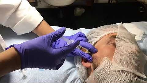 PRP Treatment for TMJ (temporomandibular)