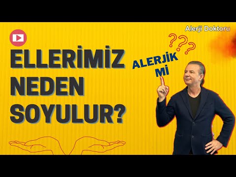 Video: Niyə əllərim təsadüfi soyulur?