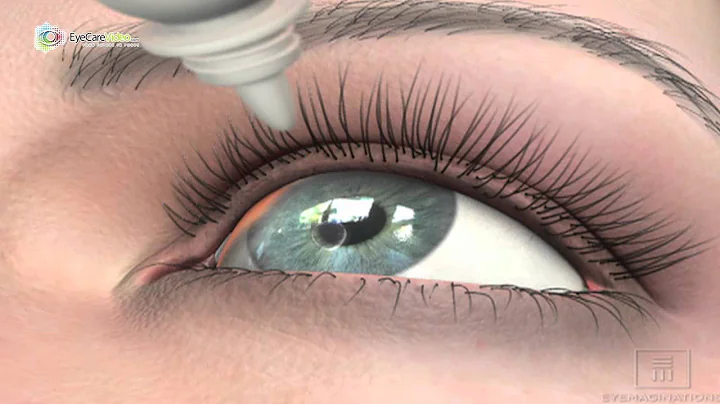 Dr. Robert Layman - Glaucoma