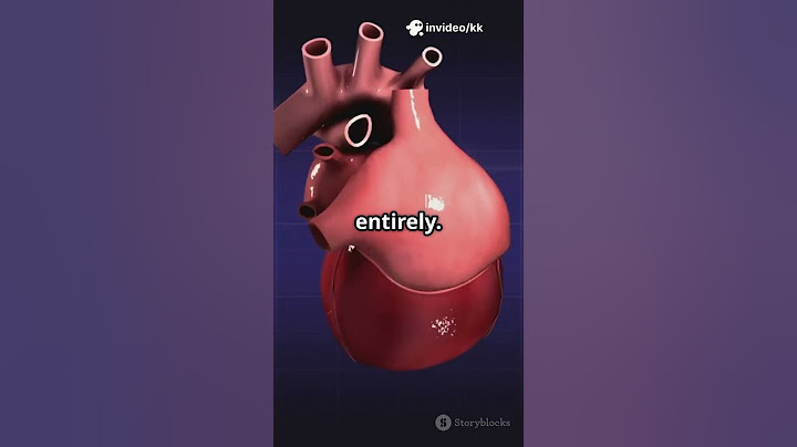 IntraVentricular Conduct Disease-IVCD #cardiology #shorts