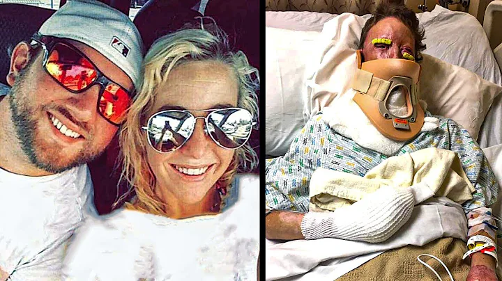 This Moms Husband Left After She Was Disfigured By...